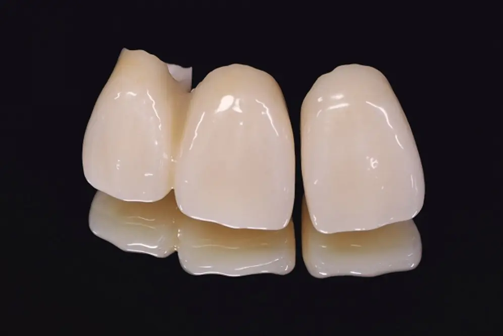 素材にこだわった歯の模型