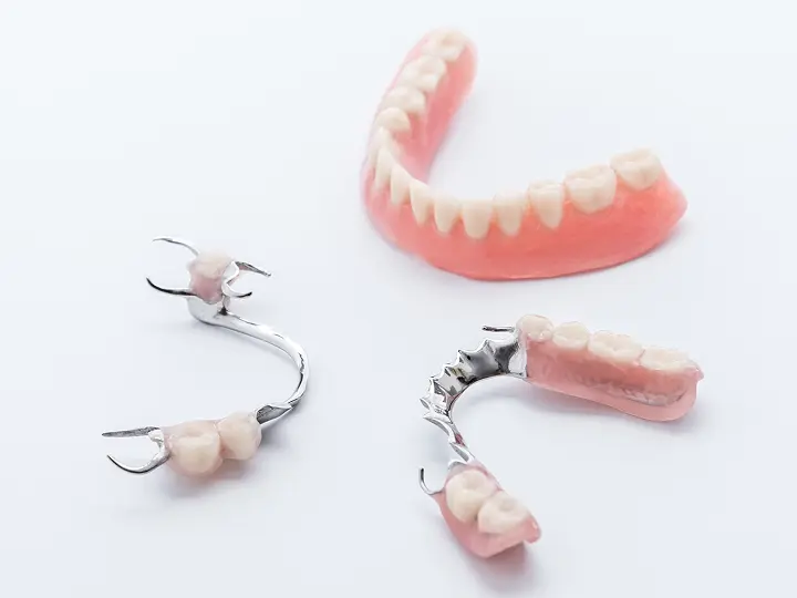 様々なタイプの入れ歯・義歯