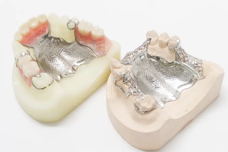 金属床義歯（きんぞくしょうぎし）