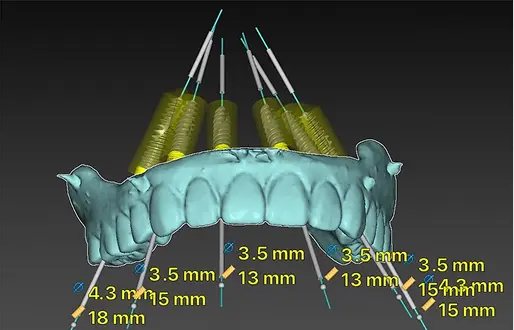 ナビゲーションシステム（Xガイド）の様子